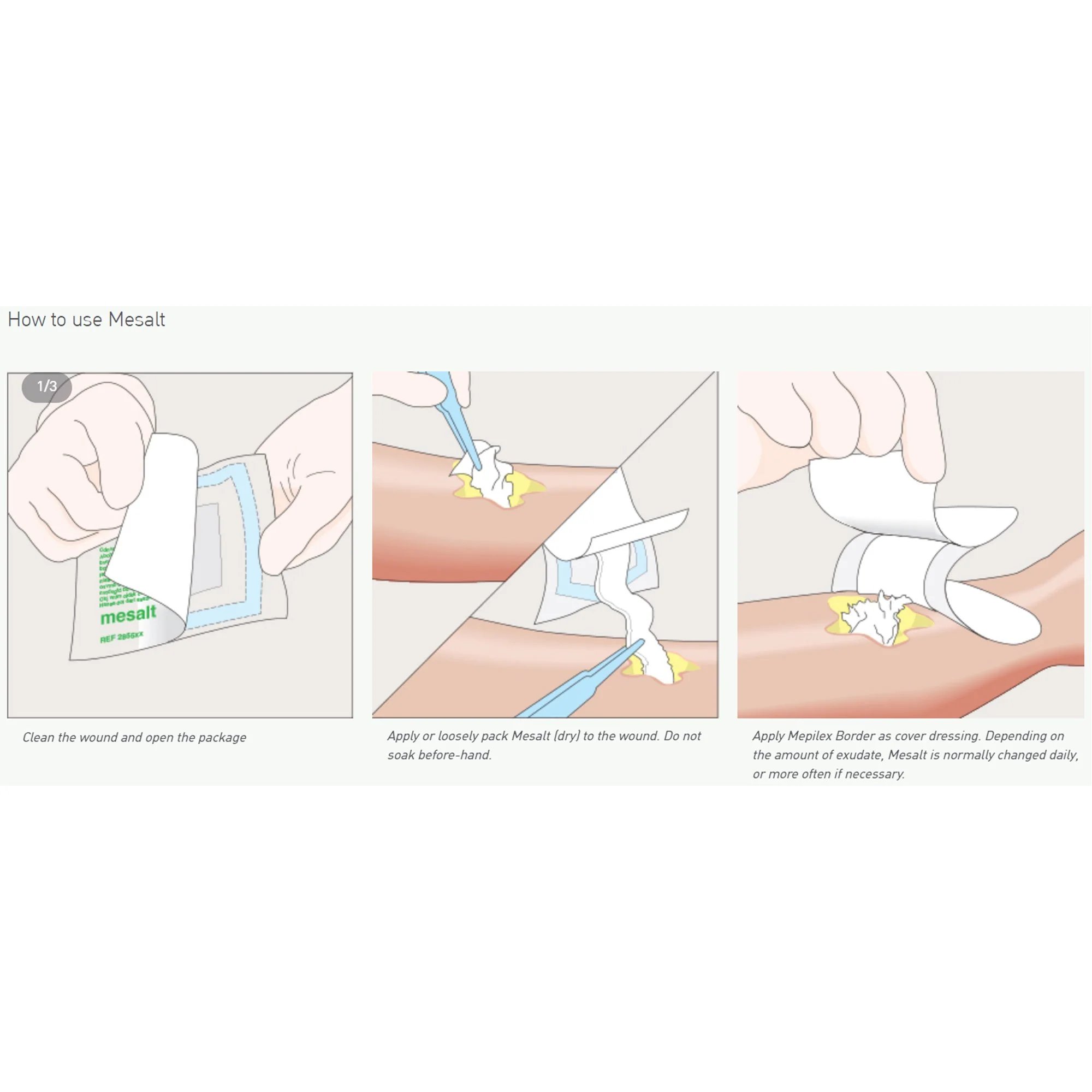 Mesalt Sodium Chloride Impregnated Dressing, Square 8 X 8 Inch / 4 X 4 Inch Folded, Sterile, Box of 30 - Image 3