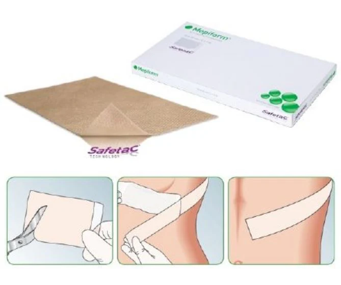 Molnlycke Mepifrom Safetec Self-Adherent Soft Silicone Dressing: 2" x 3", 5 Count