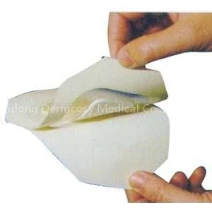 Smith & Nephew OpSite Flexifix 66000040 Transparent Retainer Dressing, 1 Each - Image 2
